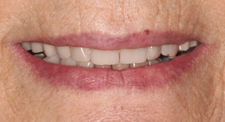 After - Nailsea Dental Practice