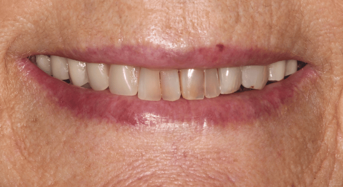 Before - Nailsea Dental Practice