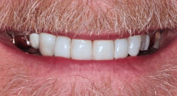 After - Nailsea Dental Practice