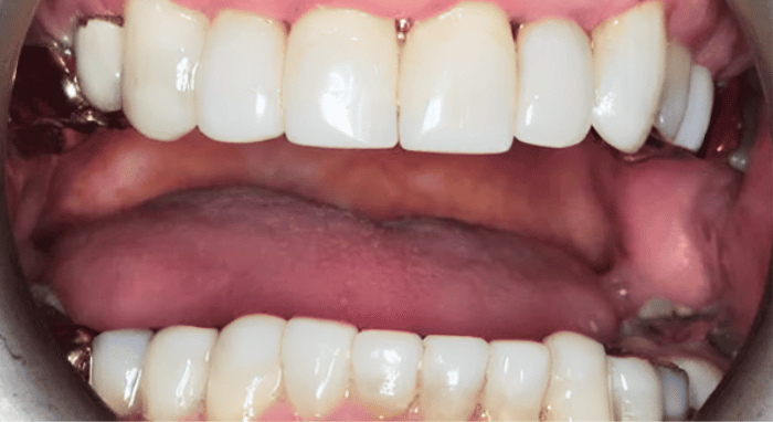 After - Nailsea Dental Practice