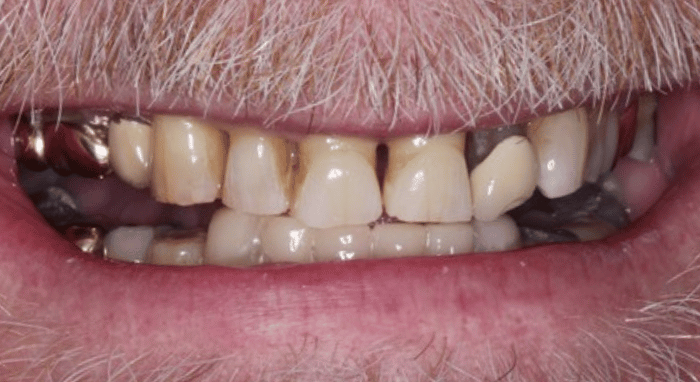 Before - Nailsea Dental Practice