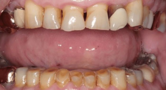 Before - Nailsea Dental Practice