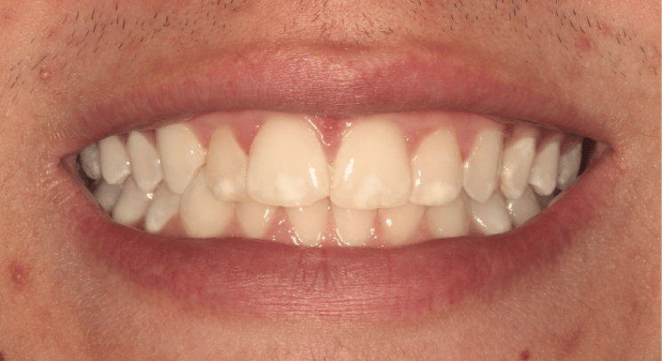 After - Nailsea Dental Practice