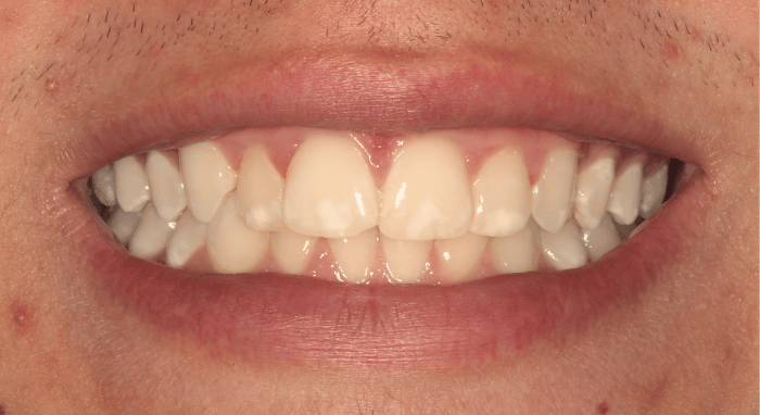 After - Nailsea Dental Practice