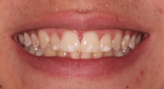 Before - Nailsea Dental Practice