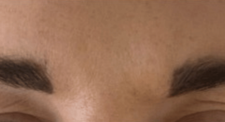 After - Nailsea Dental Practice