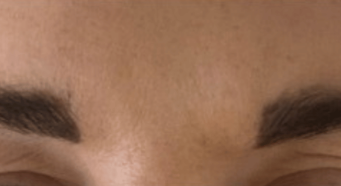 After - Nailsea Dental Practice