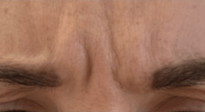 Before - Nailsea Dental Practice