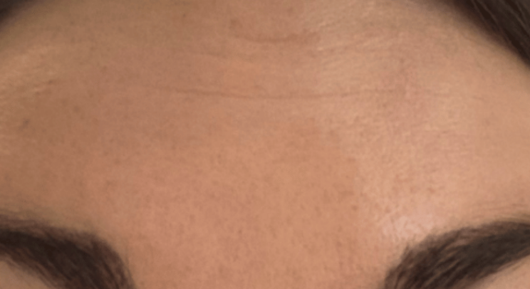 After - Nailsea Dental Practice