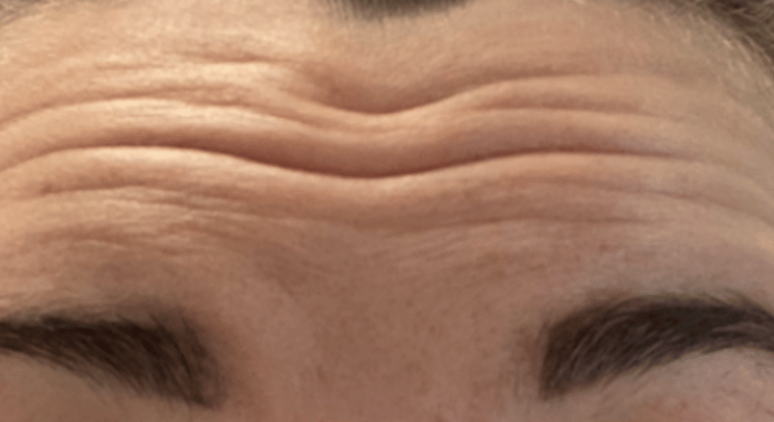 Before - Nailsea Dental Practice