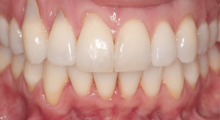 After - Nailsea Dental Practice