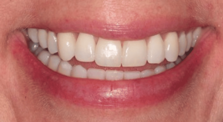 After - Nailsea Dental Practice