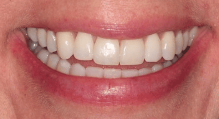After - Nailsea Dental Practice