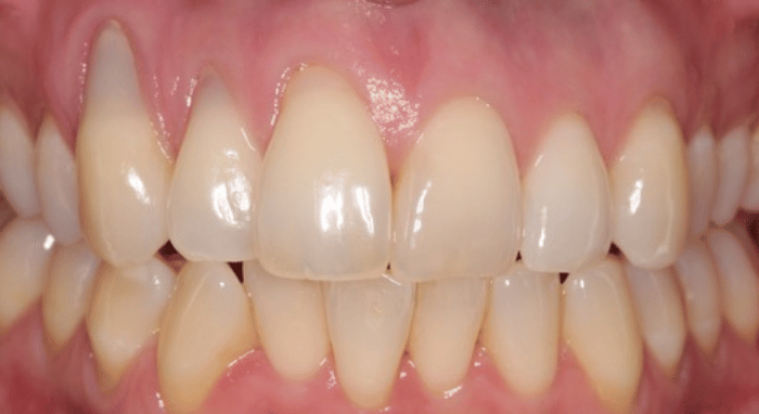 Before - Nailsea Dental Practice