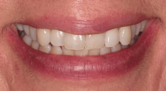 Before - Nailsea Dental Practice